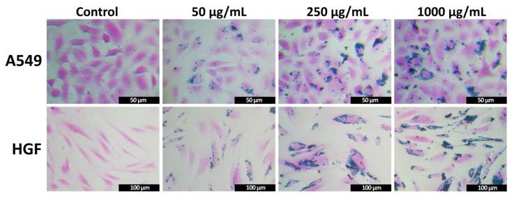 https://cdn.ncbi.nlm.nih.gov/pmc/blobs/2cce/7285148/900f590f63b9/pharmaceutics-12-00424-g007.jpg
