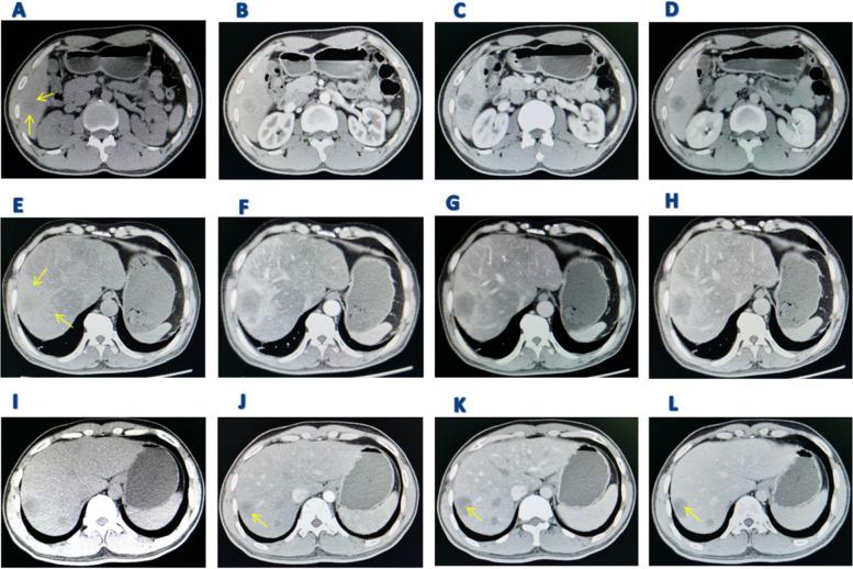 https://cdn.ncbi.nlm.nih.gov/pmc/blobs/2cd6/11437663/19267f66ee15/12885_2024_12817_Fig3_HTML.jpg