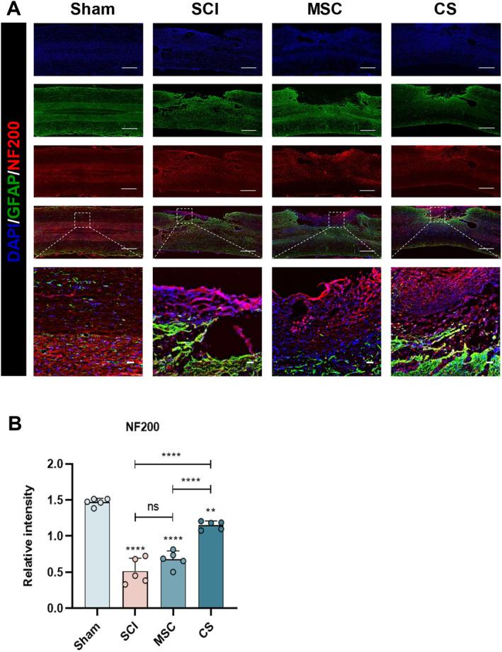 https://cdn.ncbi.nlm.nih.gov/pmc/blobs/2cda/11638885/29594471a40a/CNS-30-e70163-g004.jpg