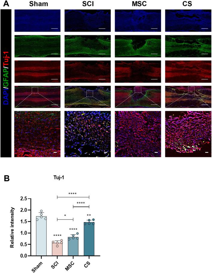 https://cdn.ncbi.nlm.nih.gov/pmc/blobs/2cda/11638885/2ea5e50863da/CNS-30-e70163-g012.jpg