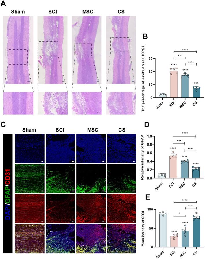 https://cdn.ncbi.nlm.nih.gov/pmc/blobs/2cda/11638885/578e318df1c6/CNS-30-e70163-g011.jpg