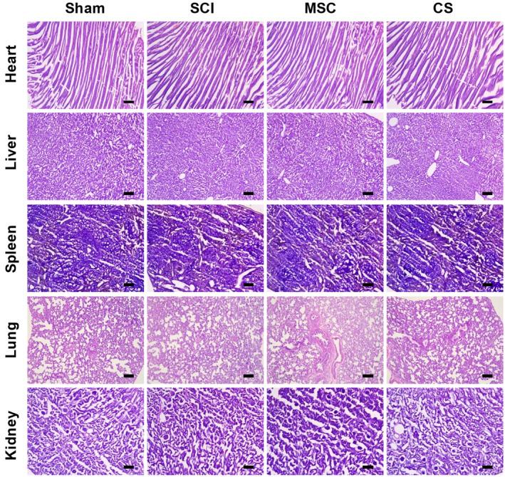 https://cdn.ncbi.nlm.nih.gov/pmc/blobs/2cda/11638885/5fb3ce9570fc/CNS-30-e70163-g010.jpg