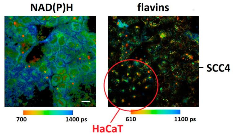 https://cdn.ncbi.nlm.nih.gov/pmc/blobs/2cda/8199032/94fc5eec7302/ijms-22-05952-g004.jpg