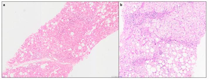 https://cdn.ncbi.nlm.nih.gov/pmc/blobs/2cdb/10814110/916329bfbdfc/diagnostics-14-00210-g007.jpg