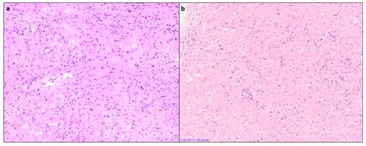 https://cdn.ncbi.nlm.nih.gov/pmc/blobs/2cdb/10814110/e228b15c113b/diagnostics-14-00210-g002.jpg