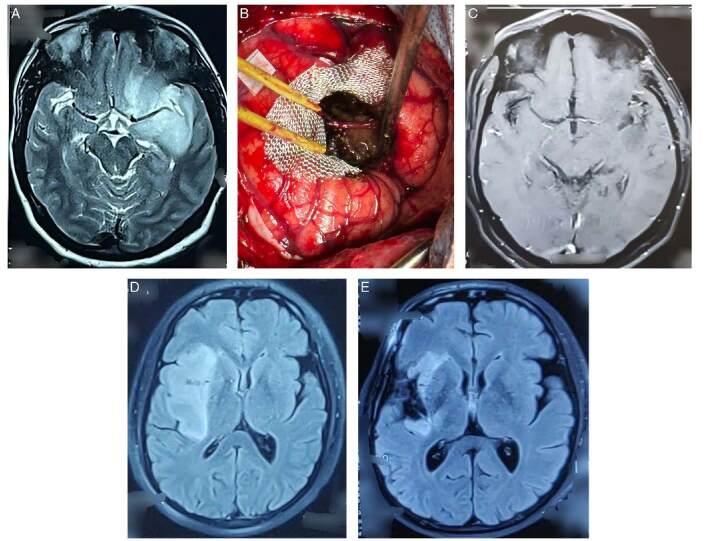 https://cdn.ncbi.nlm.nih.gov/pmc/blobs/2cdd/10990364/9e18edcbc1b6/ms9-86-1861-g005.jpg