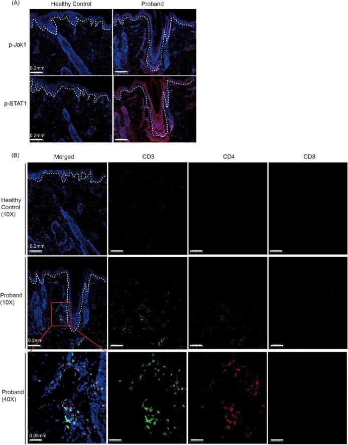 https://cdn.ncbi.nlm.nih.gov/pmc/blobs/2cdd/12321523/fcafc94dd41a/fmed-12-1574656-g002.jpg