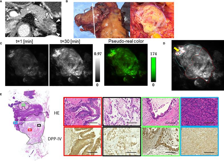 https://cdn.ncbi.nlm.nih.gov/pmc/blobs/2cdf/8417470/6c2811e8625f/fonc-11-714527-g004.jpg