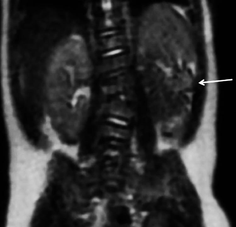 https://cdn.ncbi.nlm.nih.gov/pmc/blobs/2ce4/11298873/37ee8d5cc6fa/gr4.jpg