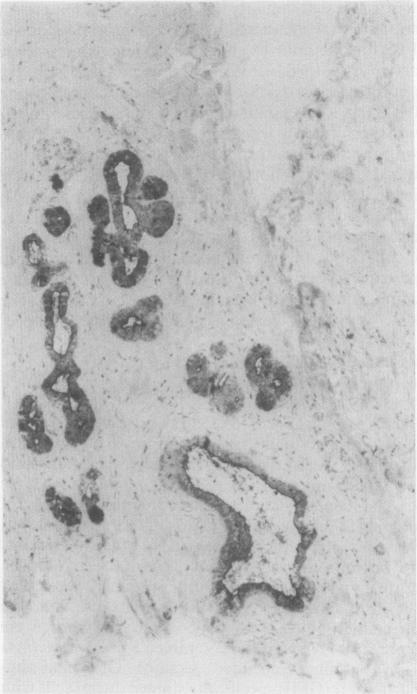 https://cdn.ncbi.nlm.nih.gov/pmc/blobs/2ce7/1141433/1e1f8f1d2fd2/jclinpath00335-0086-a.jpg