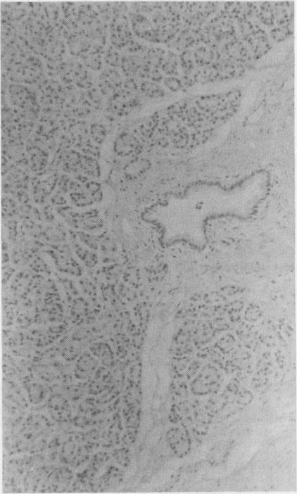 https://cdn.ncbi.nlm.nih.gov/pmc/blobs/2ce7/1141433/52743f710502/jclinpath00335-0087-b.jpg