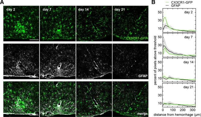 https://cdn.ncbi.nlm.nih.gov/pmc/blobs/2ce7/6023576/0b38b42d106a/str-49-1719-g006.jpg