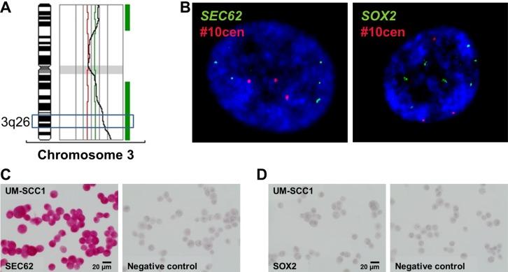 https://cdn.ncbi.nlm.nih.gov/pmc/blobs/2ce8/5354881/1d577c5b5516/oncotarget-08-4922-g004.jpg