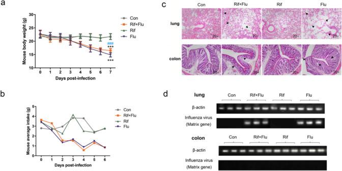 https://cdn.ncbi.nlm.nih.gov/pmc/blobs/2ced/11413070/f4fb310c7a2d/253_2024_13280_Fig1_HTML.jpg