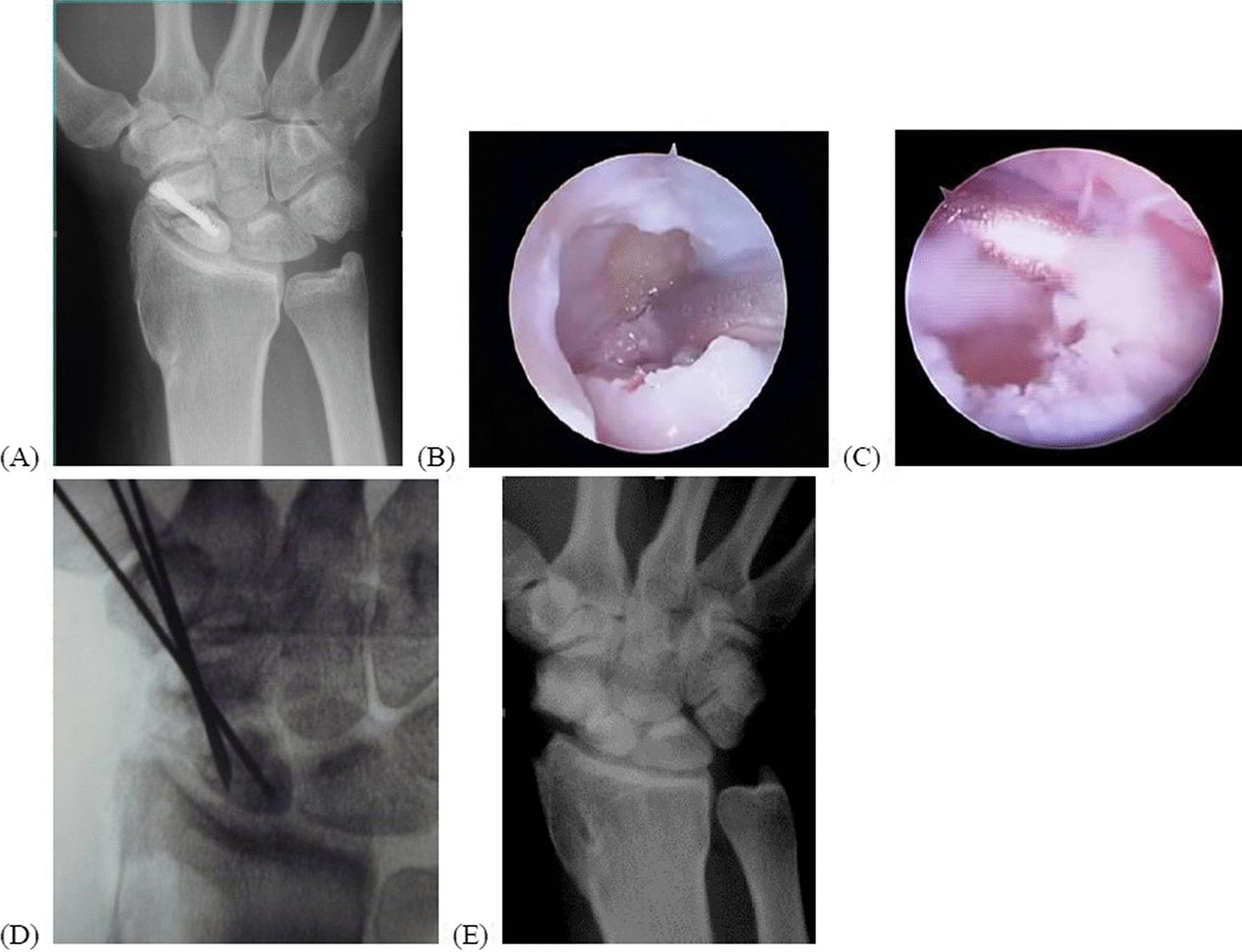 https://cdn.ncbi.nlm.nih.gov/pmc/blobs/2cf1/9942390/00298bfba9e2/13018_2023_3609_Fig4_HTML.jpg