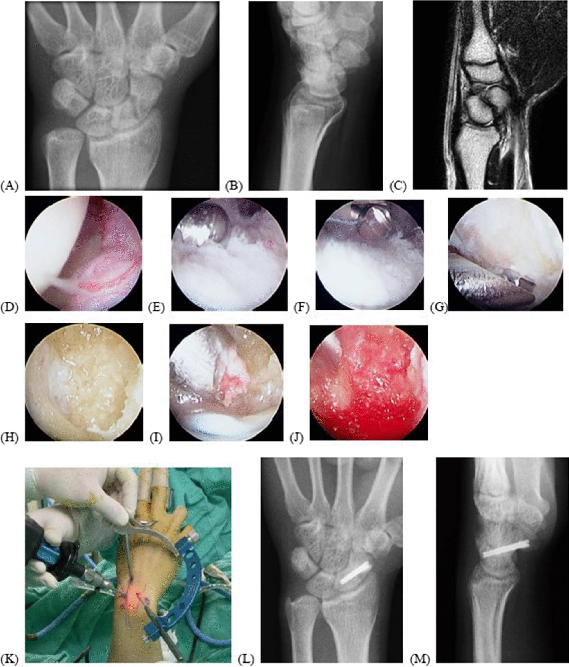 https://cdn.ncbi.nlm.nih.gov/pmc/blobs/2cf1/9942390/169f634eac27/13018_2023_3609_Fig3_HTML.jpg