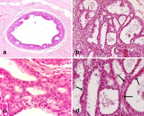 https://cdn.ncbi.nlm.nih.gov/pmc/blobs/2cf2/2335297/faeaf2b87bf2/428_2007_408_Fig1_HTML.jpg