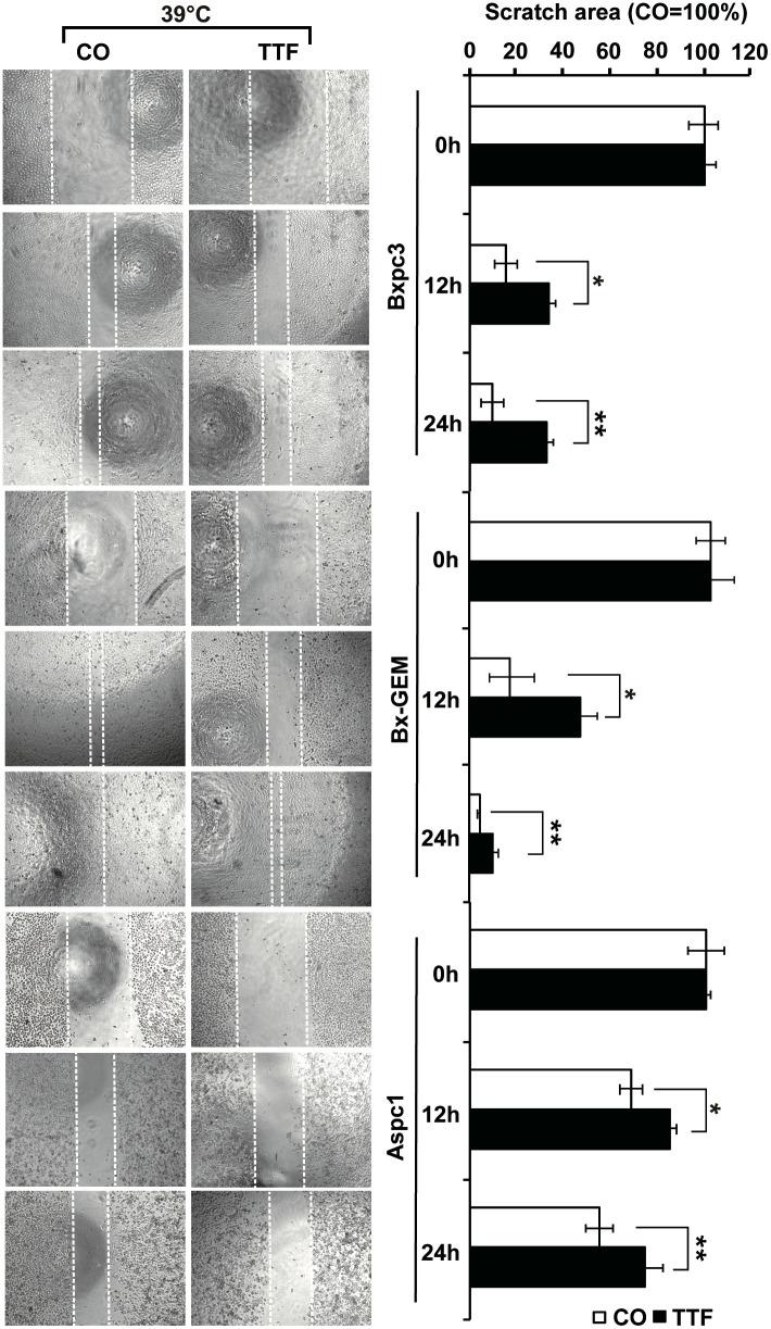 https://cdn.ncbi.nlm.nih.gov/pmc/blobs/2cf4/8597267/c43fde302db1/fonc-11-738801-g003.jpg