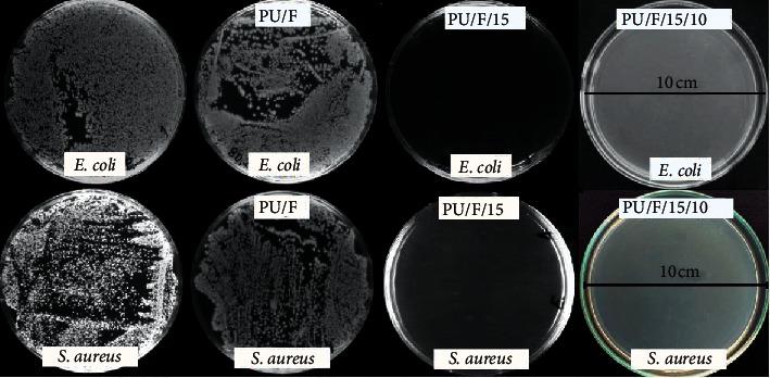 https://cdn.ncbi.nlm.nih.gov/pmc/blobs/2cf5/8140834/52f5ad3ad646/ECAM2021-6646702.007.jpg