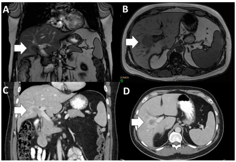 https://cdn.ncbi.nlm.nih.gov/pmc/blobs/2cfd/7796337/6031cca3f1bb/jcm-10-00104-g001.jpg