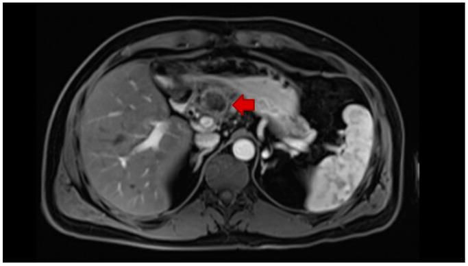 https://cdn.ncbi.nlm.nih.gov/pmc/blobs/2cfd/7796337/7b2c34c7252f/jcm-10-00104-g002.jpg