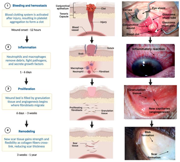 https://cdn.ncbi.nlm.nih.gov/pmc/blobs/2cff/11117829/5748c7a742e0/bioengineering-11-00446-g003.jpg
