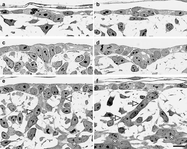 https://cdn.ncbi.nlm.nih.gov/pmc/blobs/2d00/2782127/699dd68ec1a5/429_2009_228_Fig1_HTML.jpg
