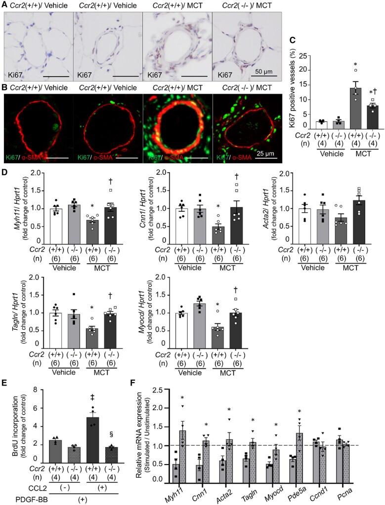 https://cdn.ncbi.nlm.nih.gov/pmc/blobs/2d04/12236072/65acdf303503/cvae244f5.jpg