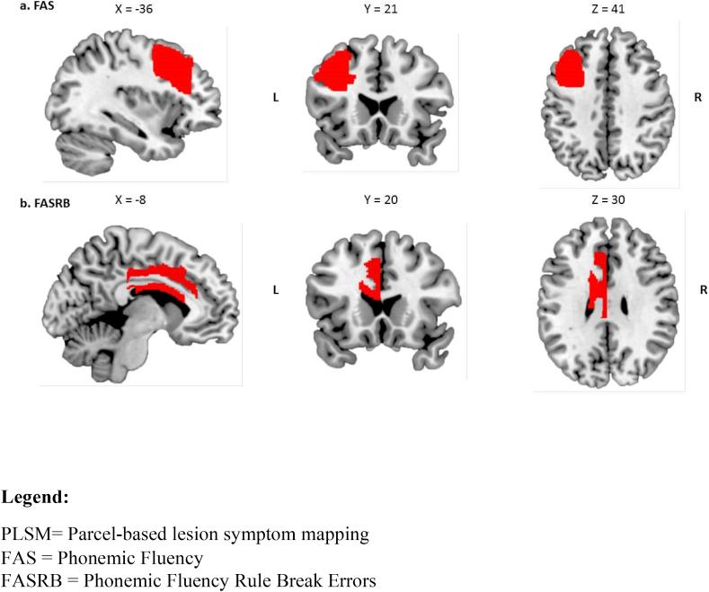 https://cdn.ncbi.nlm.nih.gov/pmc/blobs/2d04/6996283/96dfdf9bf560/gr5.jpg