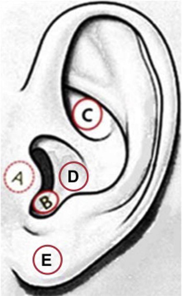 https://cdn.ncbi.nlm.nih.gov/pmc/blobs/2d08/6550115/8cb266656c25/gr1.jpg