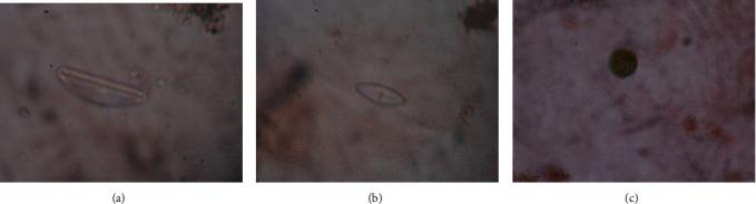 https://cdn.ncbi.nlm.nih.gov/pmc/blobs/2d0e/7578733/2546348fdc61/BMRI2020-5830604.005.jpg