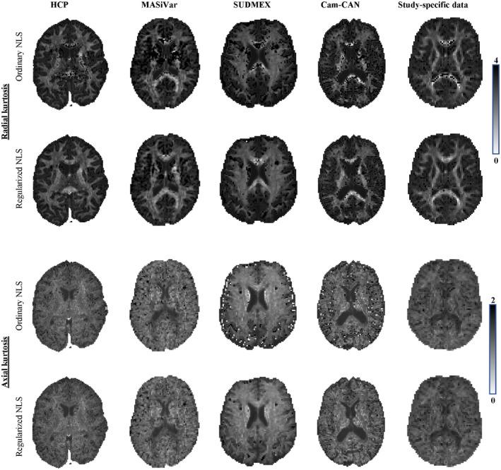 https://cdn.ncbi.nlm.nih.gov/pmc/blobs/2d16/8251981/4445a4b24fd5/MRM-86-1600-g006.jpg