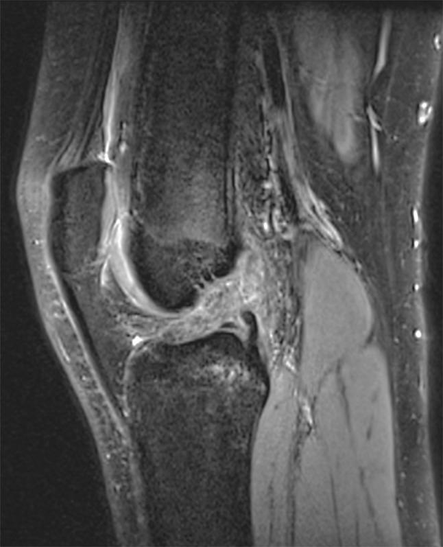 https://cdn.ncbi.nlm.nih.gov/pmc/blobs/2d17/4417740/e2ea3a1c6a09/11832_2015_652_Fig1_HTML.jpg