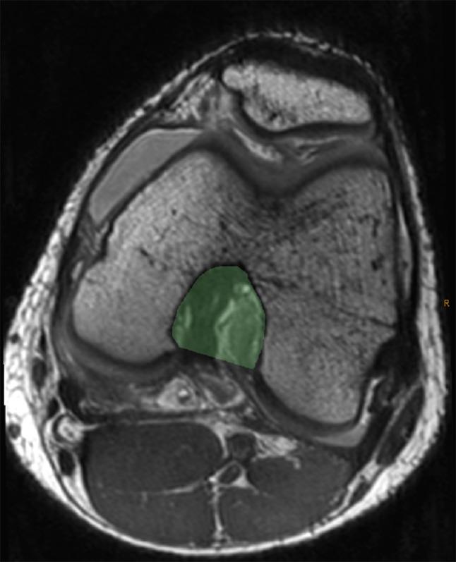 https://cdn.ncbi.nlm.nih.gov/pmc/blobs/2d17/4417740/e973ebbbefc2/11832_2015_652_Fig5_HTML.jpg
