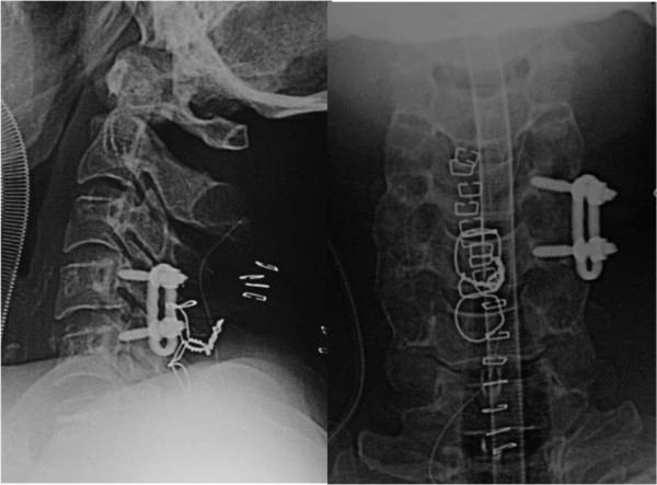 https://cdn.ncbi.nlm.nih.gov/pmc/blobs/2d1a/4205778/43fc6e0e031b/1752-1947-8-344-3.jpg