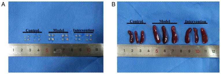 https://cdn.ncbi.nlm.nih.gov/pmc/blobs/2d1d/9175275/c3e34c839282/mmr-26-01-12739-g02.jpg