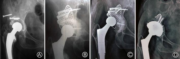 https://cdn.ncbi.nlm.nih.gov/pmc/blobs/2d1e/9977582/1931107350ae/OS-15-750-g005.jpg