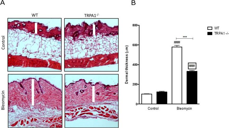 https://cdn.ncbi.nlm.nih.gov/pmc/blobs/2d25/9875496/4fbbea6ec8a6/13075_2023_2994_Fig1_HTML.jpg