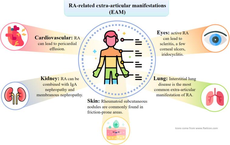 https://cdn.ncbi.nlm.nih.gov/pmc/blobs/2d26/12259611/d7097ceb44d2/fimmu-16-1608909-g002.jpg