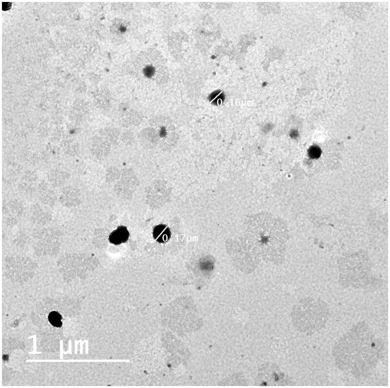 https://cdn.ncbi.nlm.nih.gov/pmc/blobs/2d35/8812757/5b0eb8b7393a/IDRD_A_2032875_F0003_B.jpg