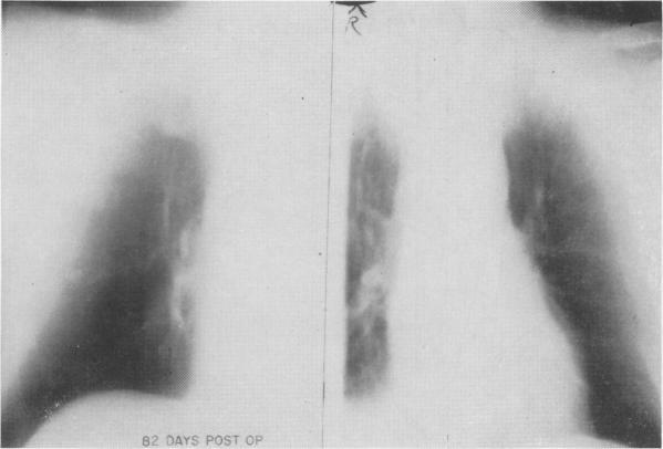 https://cdn.ncbi.nlm.nih.gov/pmc/blobs/2d38/1387356/5345339f6a9b/annsurg00429-0191-a.jpg