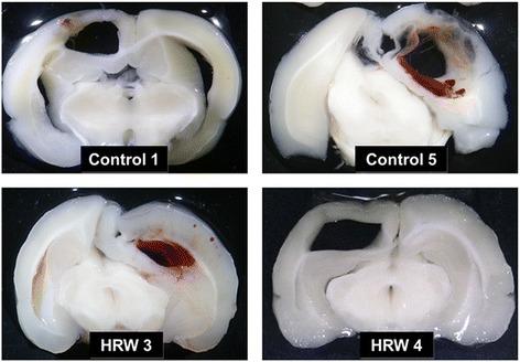 https://cdn.ncbi.nlm.nih.gov/pmc/blobs/2d3f/4411925/64182e5c10fb/12868_2015_165_Fig2_HTML.jpg