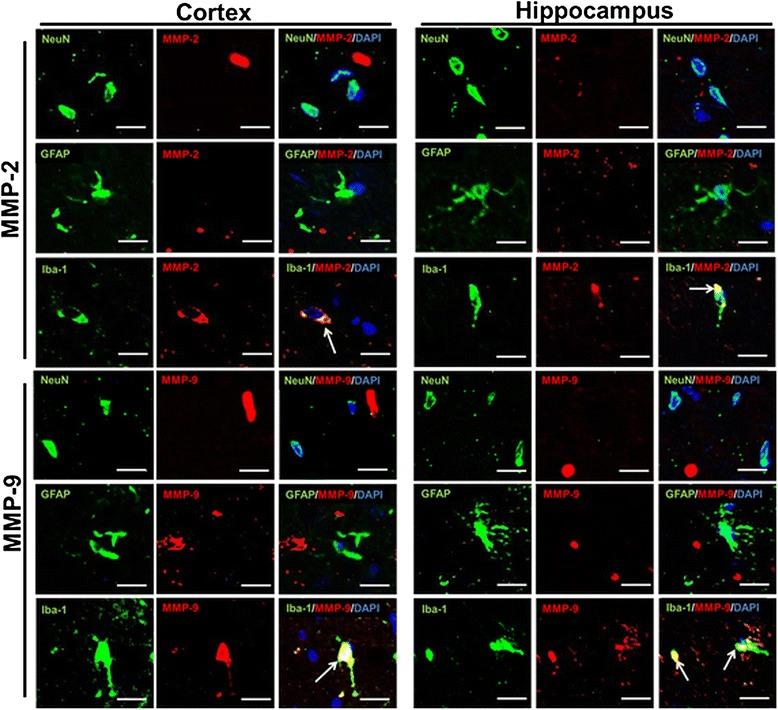 https://cdn.ncbi.nlm.nih.gov/pmc/blobs/2d3f/4411925/9a29bae5c404/12868_2015_165_Fig9_HTML.jpg
