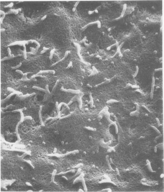 https://cdn.ncbi.nlm.nih.gov/pmc/blobs/2d44/515888/6110ca361471/jvirol00213-0336-a.jpg