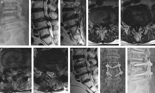 https://cdn.ncbi.nlm.nih.gov/pmc/blobs/2d45/8035997/091b14af58fd/bsd-34-e64-g004.jpg