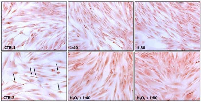 https://cdn.ncbi.nlm.nih.gov/pmc/blobs/2d48/9920497/fbd4158ff254/molecules-28-01222-g004.jpg