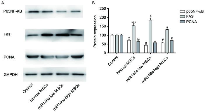 https://cdn.ncbi.nlm.nih.gov/pmc/blobs/2d4c/6102633/d3a82f6802eb/MMR-18-03-3203-g02.jpg