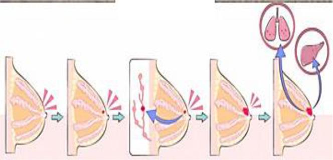 https://cdn.ncbi.nlm.nih.gov/pmc/blobs/2d51/11246735/6a5aeca03bd9/JFRH-18-129-g011.jpg