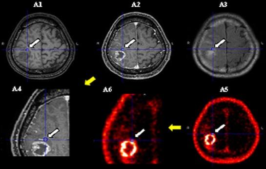 https://cdn.ncbi.nlm.nih.gov/pmc/blobs/2d51/5221680/5d690547b9cd/AOJNMB-5-10-g002.jpg