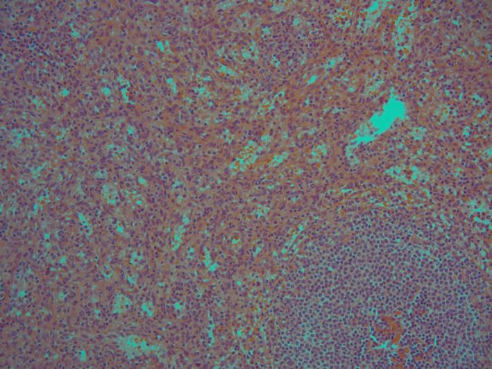 https://cdn.ncbi.nlm.nih.gov/pmc/blobs/2d57/8710848/8c4ff5eeab40/CCR3-9-e05225-g001.jpg